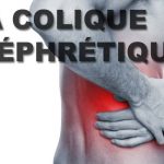 Colique-néphrétique