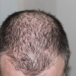hair-248050_960_720