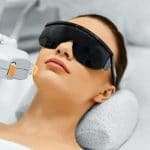 laser-facial