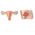 the-uterus-2947707_960_720