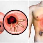 Voici-comment-eliminer-les-bacteries-qui-causent-les-brulures-destomac-et-des-ballonnements-725×375