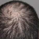 hair-248049_960_720