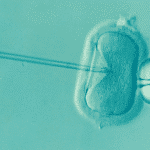 ivf-1514174_960_720