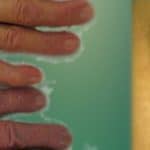 le-syndrome-et-la-bilirubine-de-gilbert-causes_1